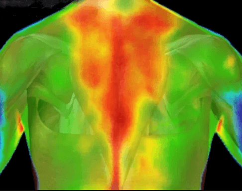 Thermal  Imaging